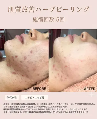 肌質改善専門サロン Bellmi/心斎橋のエステ・リラクイメージ