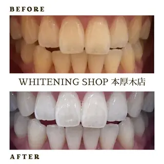 メンズ ホワイトニング ショップ本厚木のその他イメージ