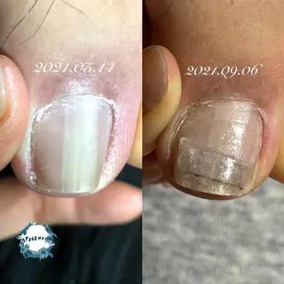 ネイル roconail ヒロコのネイルデザイン