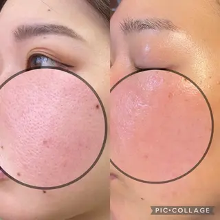 SOYOU所属・岡崎🦋SOYOU 韓国肌管理のエステ・リラクイメージ