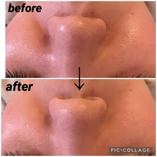 ナリスビューティーサロンつくば店所属・バストアップサロン -Sirius-かずのエステ・リラクイメージ