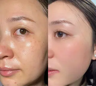 ショート 愛維美水光美肌専門店所属・愛維美水光美肌専門店 メンズレディースokのエステ・リラクイメージ