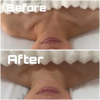 【敏感肌管理×小顔サロン】Belle orchid所属・敏感肌×小顔サロン 玲央奈のエステ・リラクイメージ