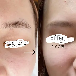 アイブロウ 脱毛サロン KiWiのエステ・リラクイメージ