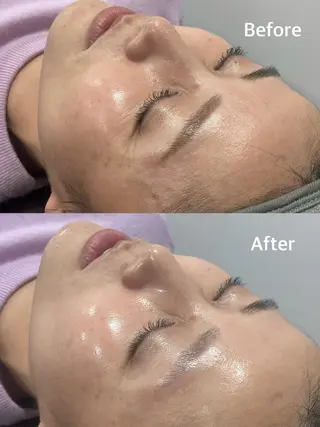 小顔専門看護師クリニカルサロンCOCO所属・小顔と美肌サロン クリニカルサロンココのエステ・リラクイメージ