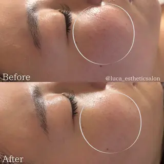 Luca所属・Luca ﾙｶのエステ・リラクイメージ