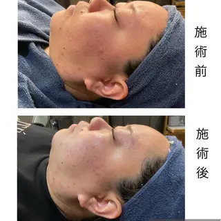 leolo武蔵浦和 肌質改善＆脱毛のエステ・リラクイメージ