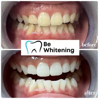 ホワイトニングサロン BE WHITE金山のその他イメージ