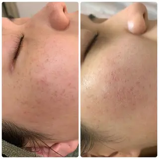 美肌&アロマ🌸 nana 中目黒のエステ・リラクイメージ