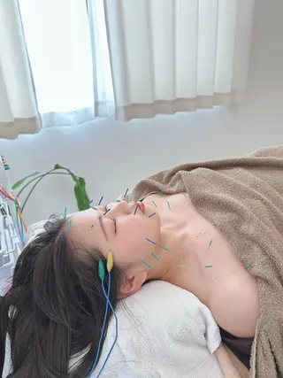 美容鍼＆鍼灸サロン 鍼Glitter.所属・田中 美奈のエステ・リラクイメージ