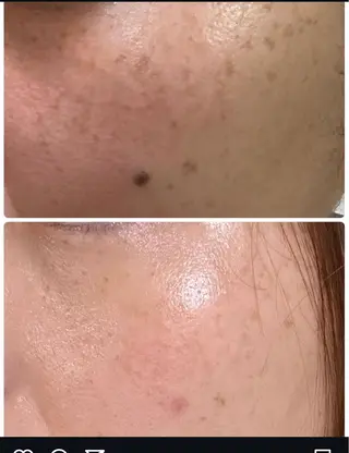 肌質改善🕊️ hirokoのエステ・リラクイメージ