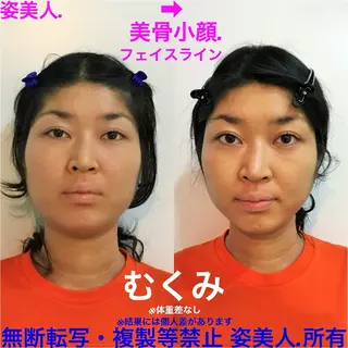 筋膜整体＆小顔矯正 　姿美人.シルエットのエステ・リラクイメージ