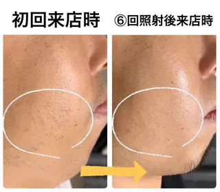 メンズ メンズ脱毛サロン Le falcoのエステ・リラクイメージ