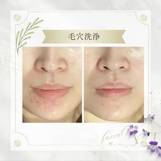 《 肌質×美肌 》 addissimoのエステ・リラクイメージ