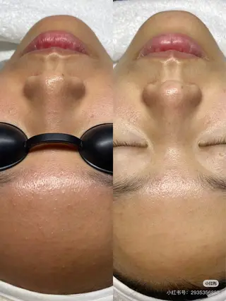 マツエク・マツパ aliaハイフ&水光ジェットサロン所属・aliaハーブ水光店 エステティシャン募集のエステ・リラクイメージ