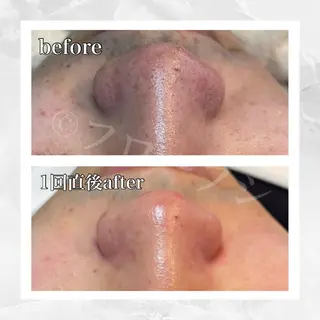 部分痩せ♥️小顔専門 MIKUのエステ・リラクイメージ