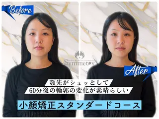 SYMMETRY SAPPOROのエステ・リラクイメージ