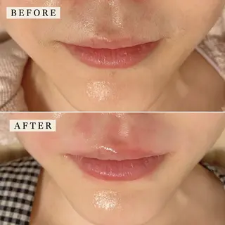 【産毛・眉毛ケア＆肌質改善サロン】＊BiBi＊beautysalon所属・眉･産毛専門BiBi 糸脱毛スレッティングのエステ・リラクイメージ