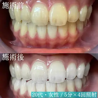 LBSホワイトニング 新宿店💝公式のその他イメージ