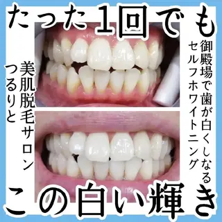 美肌脱毛サロン つるりと御殿場店所属・美肌脱毛サロン つるりとのその他イメージ