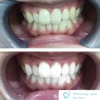 セルフホワイトニングサロンfascimo所属・ホワイトニングサロン fascimo新座店のその他イメージ