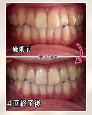 美 Happy所属・美 Happyのエステ・リラクイメージ