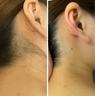 脱毛・エステサロン LuLuNのエステ・リラクイメージ