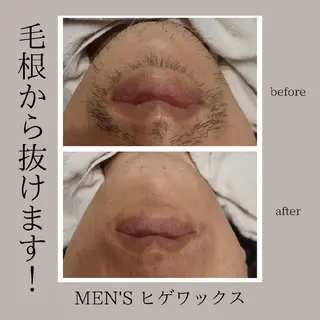 メンズ Lutella所属・ワックス脱毛専門店 Lutellaのエステ・リラクイメージ