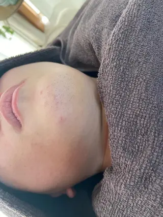 メンズ 都度払い制脱毛サロンBe Charm所属・Be Charm 山﨑のエステ・リラクイメージ