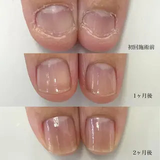 ネイル TiALASH ＊Kozue＊のネイルデザイン