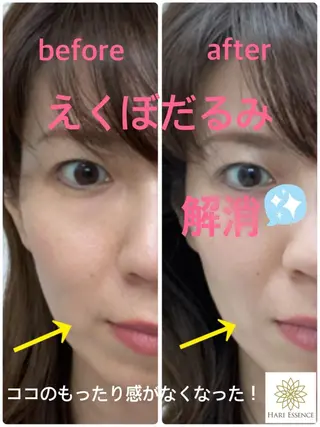 美容鍼灸専門院　ハリエッセンス所属・美容鍼専門鍼灸院 ハリエッセンスのその他イメージ