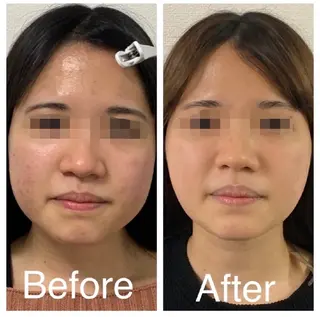 肌質改善Beauty salon Renのエステ・リラクイメージ