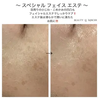 ビューティー ミロワールのエステ・リラクイメージ