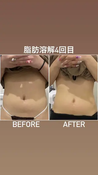 毛穴洗浄・痩身・脱毛 /アルカンジュのエステ・リラクイメージ