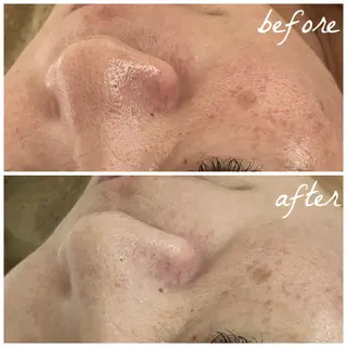 メンズ メナード岐阜茜部 杉浦のエステ・リラクイメージ