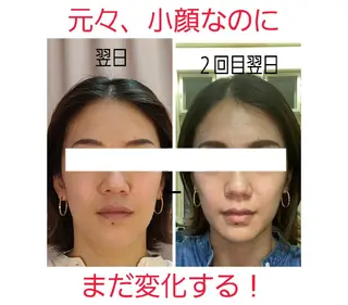 小顔と美肌 まごころエステMatoria所属・小顔 美肌専門 Matoriaのエステ・リラクイメージ