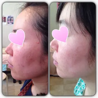 フェイシャルワックス 自然派エステファーノのその他イメージ