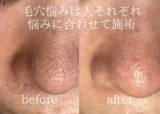 Peerless所属・chi kaのエステ・リラクイメージ