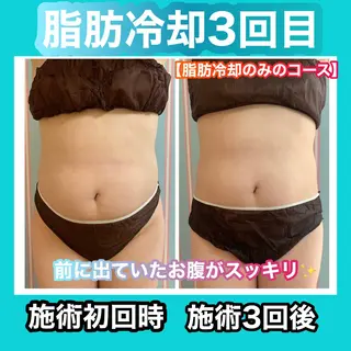 痩身/脱毛/ネイル HARUKAのエステ・リラクイメージ