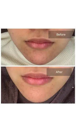 トータルしみケア専門 NICA(ニカ)のエステ・リラクイメージ