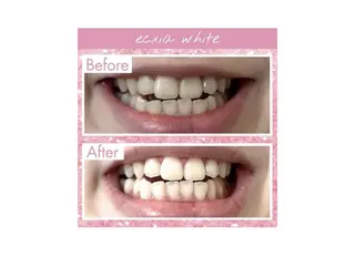 セルフホワイトニング エクシア大阪梅田店のその他イメージ