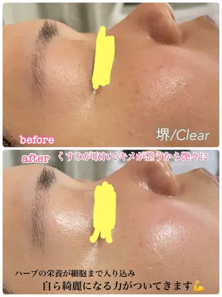 Clear所属・贅沢プライベート サロンClearのエステ・リラクイメージ