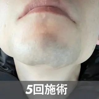 メンズ GLOW by MKのエステ・リラクイメージ