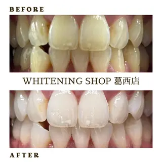 メンズ ホワイトニング ショップ葛西店のその他イメージ