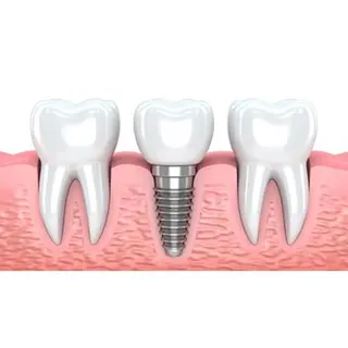 ロング パーマ ホワイトニングサロン nico西葛西店のその他イメージ