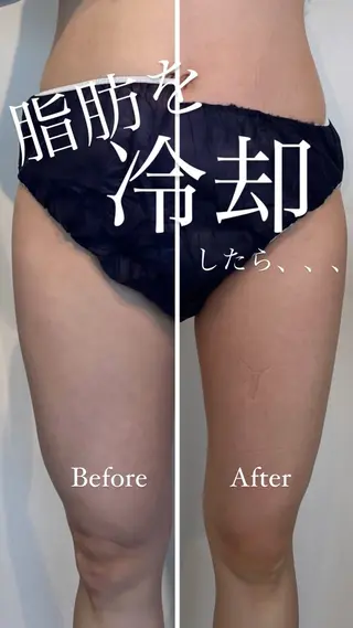 綺麗のひみつ グランプリ受賞店のエステ・リラクイメージ