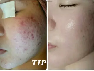 フェイシャル専門 肌質改善/プランスのエステ・リラクイメージ