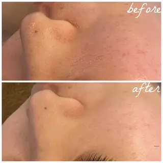 メンズ メナード岐阜市茜部 杉浦のエステ・リラクイメージ