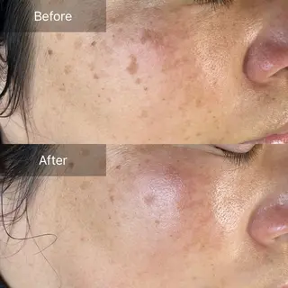 毛穴が見えなくなるサロン  Horo所属・岡 えり子のエステ・リラクイメージ