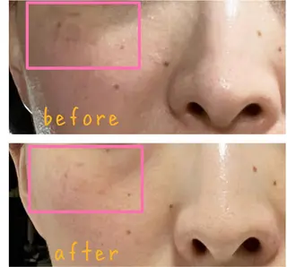 糸島 エステサロンmiuのエステ・リラクイメージ